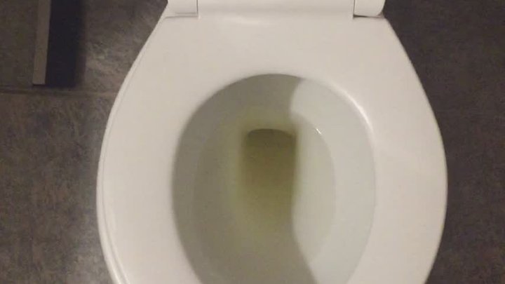I PISS GOLD IN MY TOILET =)