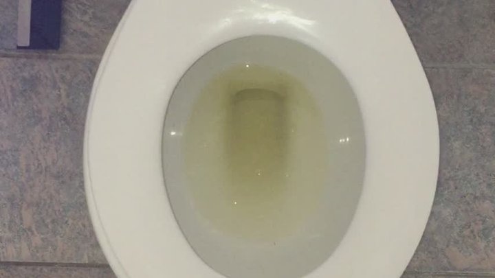 I PEE GOLD IN MY TOILET POV
