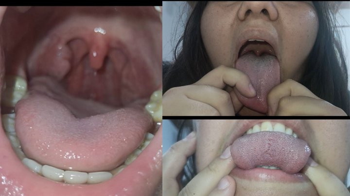 Super dirty tongue (2 days of dirt)