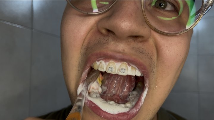 Close-Up:My mouth in full view. Whispers and Foam