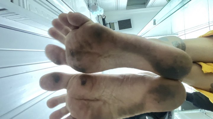 feet after walking barefoot on the street.