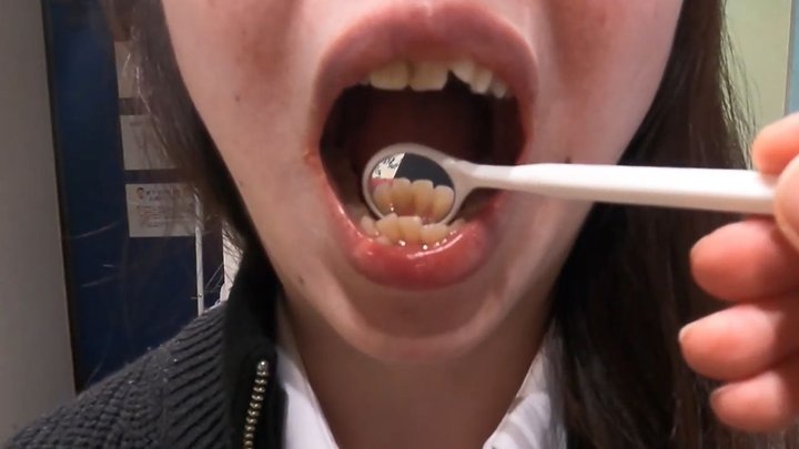Real Amateur – Beautiful Married Woman’s Detailed Dental Checkup (Extreme Mouth 