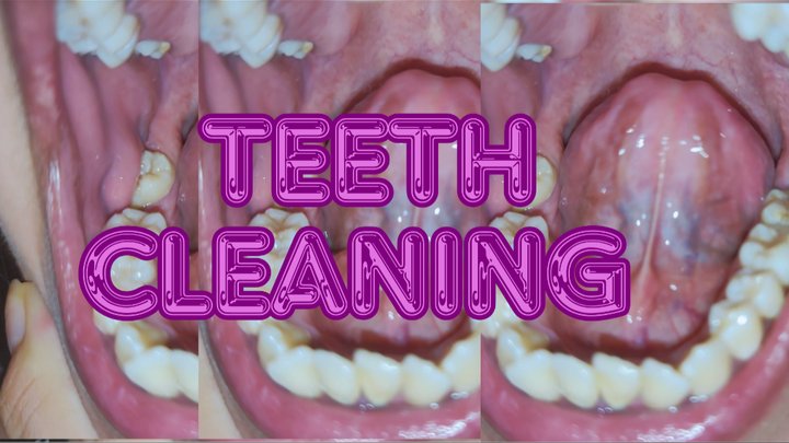 Teeth cleaning