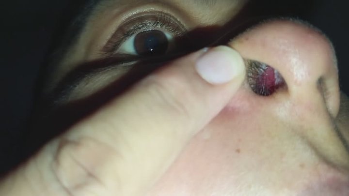 Mostrando el interior de mi nariz _ pelitos y mocos de cerca.