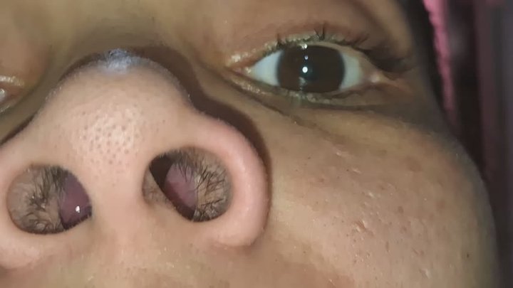 Inside my nose