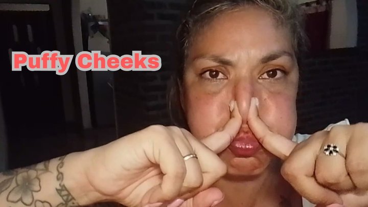 swollen cheeks