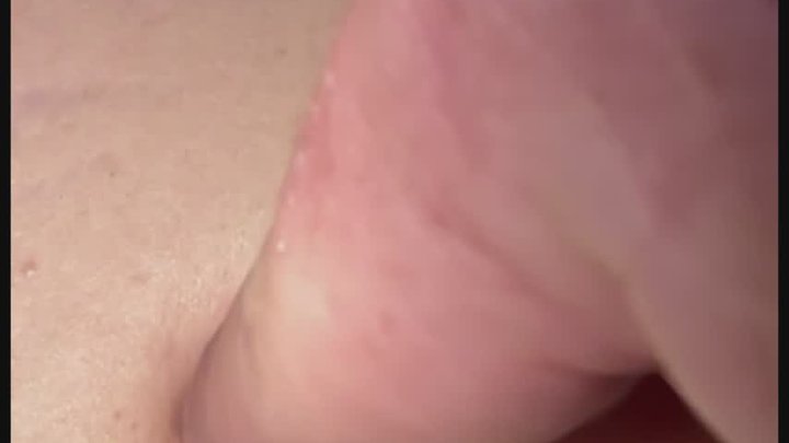 Bellybutton screwed again!