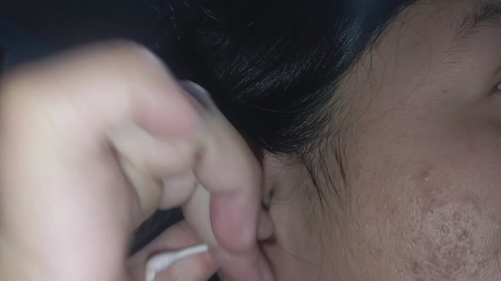 Ear Cleaning – Removing Earwax