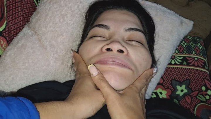 Deformity in my expression