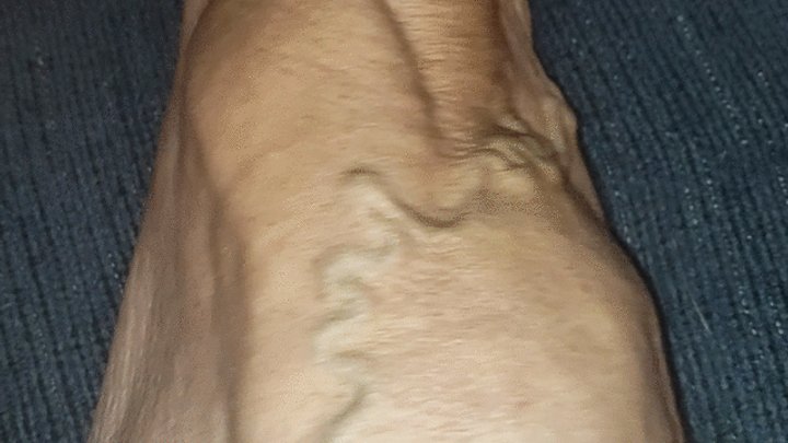 Tempest gets a special request to show off quads