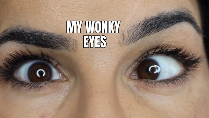 My wonky eyes - OnlyVanessa