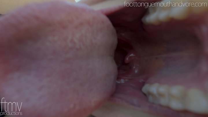 The Mouth Trap