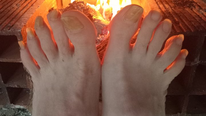 Gnarlie Harper and His Sweaty Socks, Ugly Toenails & Cold Wet Feet Warming Up by