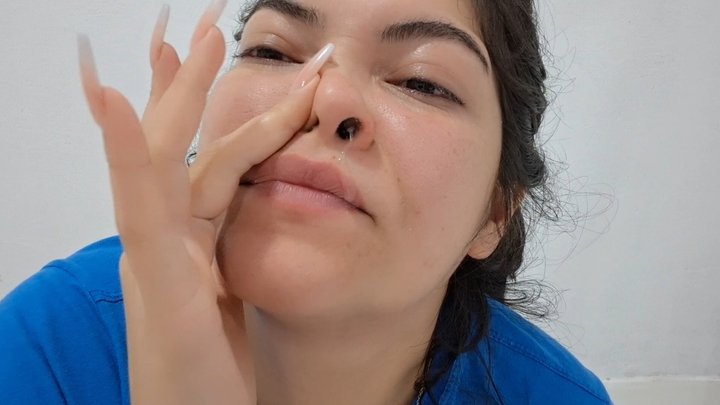 Snot all over the place - Blow your nose