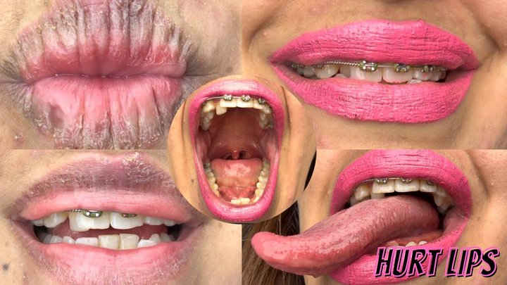 From Cracked Lips to Pretty Pink Lipstick Plus Close-Ups of My Big Mouth & Extra