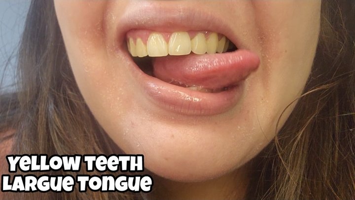 Yellow Teeth & Wet Tongue Showcase - Mouth Close Up