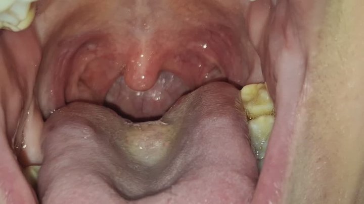 The depth of my uvula