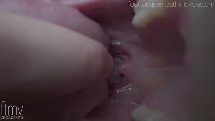 Uvula Touching No Gag