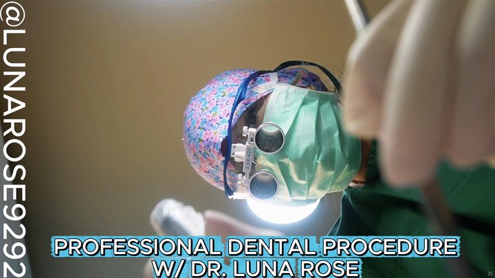 PROFESSIONAL DENTAL PROCEDURE WITH DR. LUNA POV