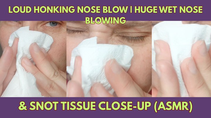 Loud Honking Nose Blow Huge Wet Nose Blowing & Snot Tissue Close-Up (ASMR)