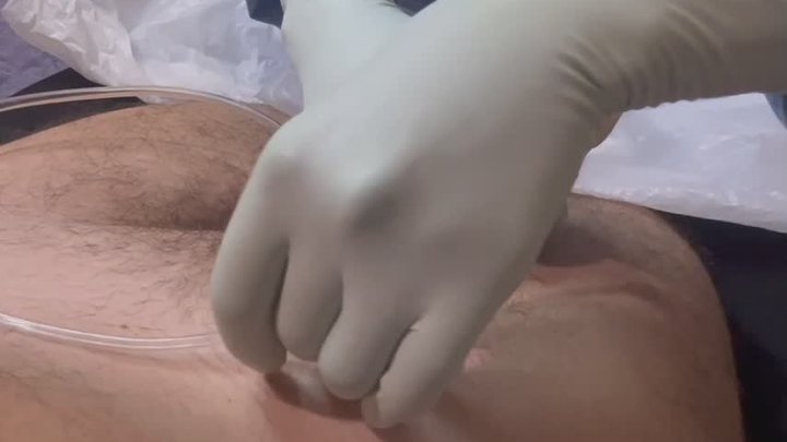 Nurse milks patient's Dick and makes him cum into the catheter bag - milking Lat