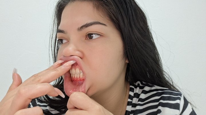 From Lip to Nose. Extreme Lip Stretching