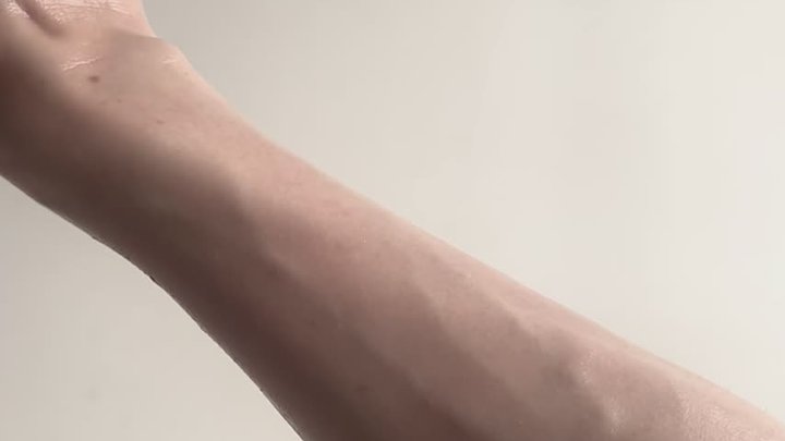 VEINY HANDS TOUCH