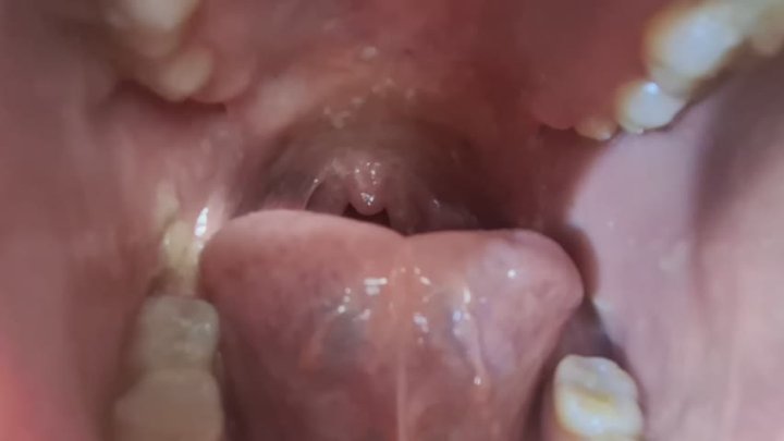 OBSERVING KIARA'S MOUTH – KIARA FULL HD (10 minuts eating, 19 minuts against the