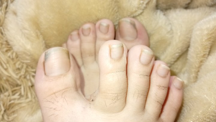 Lola's sweaty and dirty feet