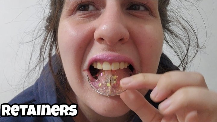 New Retainers First Wear - Heavy Saliva & Mouth Play