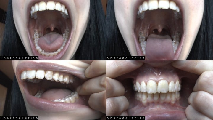 Teeth, Tongue, Uvula